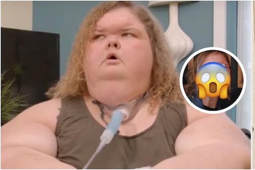 Perdió 234 kilos y ahora presume nuevos dientes: Protagonista de “Kilos mortales” muestra su nuevo aspecto