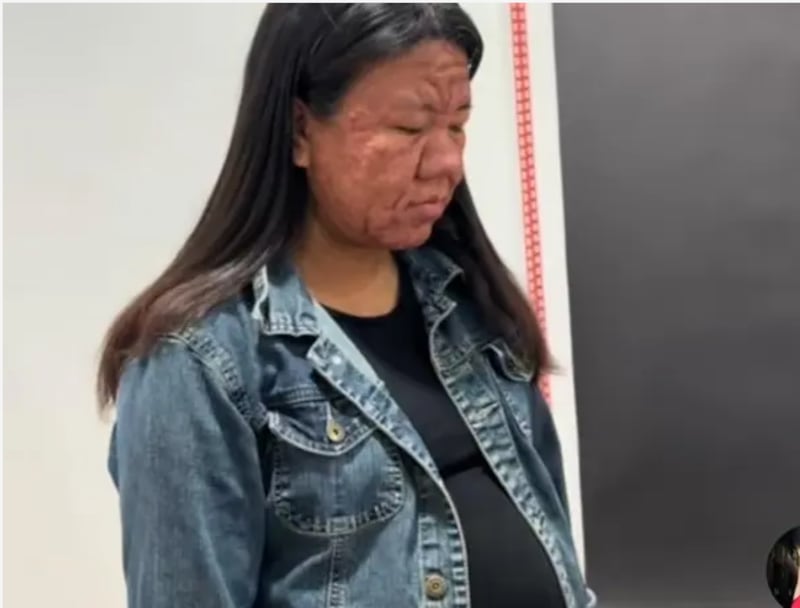 El impactante cambio físico en su rostro que tuvo una mujer durante y después de su embarazo