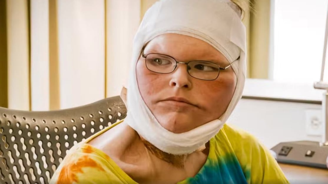 Tras bajar más de 200 kg, una de las hermanas de Kilos Mortales mostró el resultado de su cirugía de eliminación de piel.