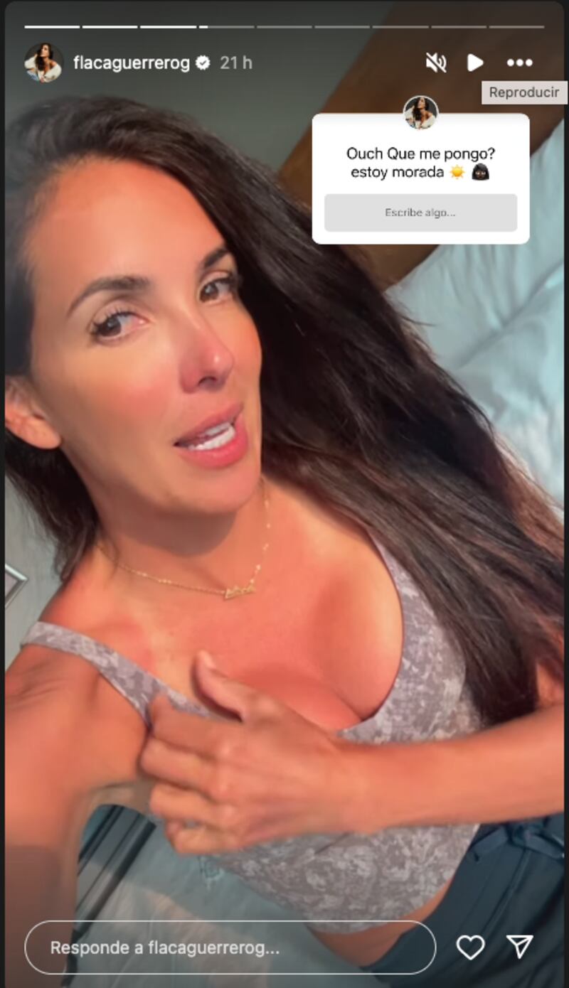 Elba González y la ‘Flaca’ Guerrero vivieron un inesperado incidente por el sol en Galápagos