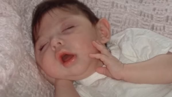 Nació sin cerebro y hoy tiene 20 años: el milagro que desafió a la cien