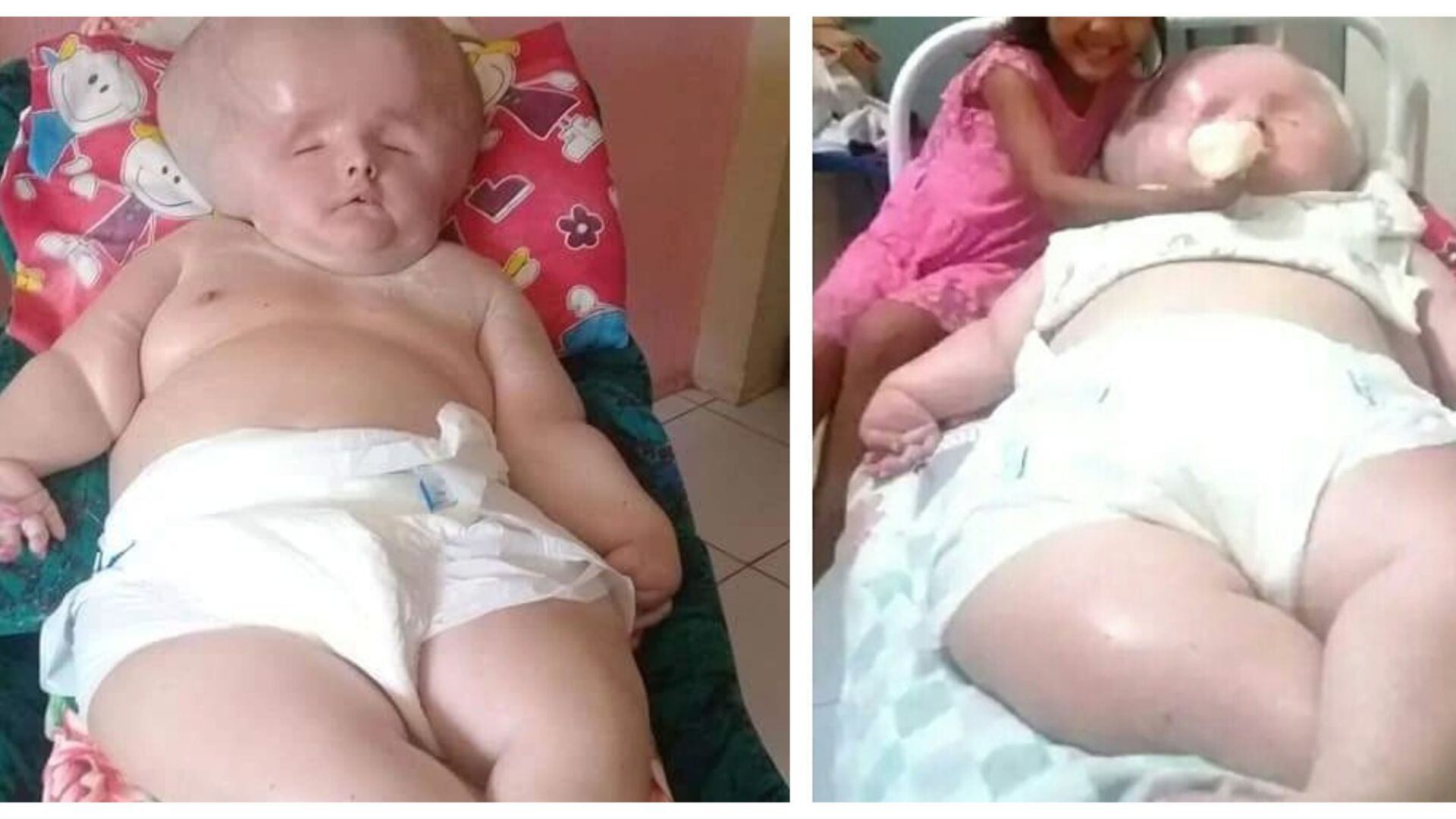 Bebé gigante pesa 69 kilos, esta es su asombrosa historia // IG: adalgisasoaresalves