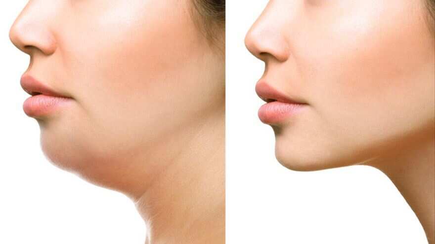 Técnica para lucir más guapo.