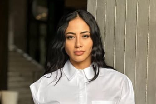 Tami Rivera: el verdadero antes y después de su operación