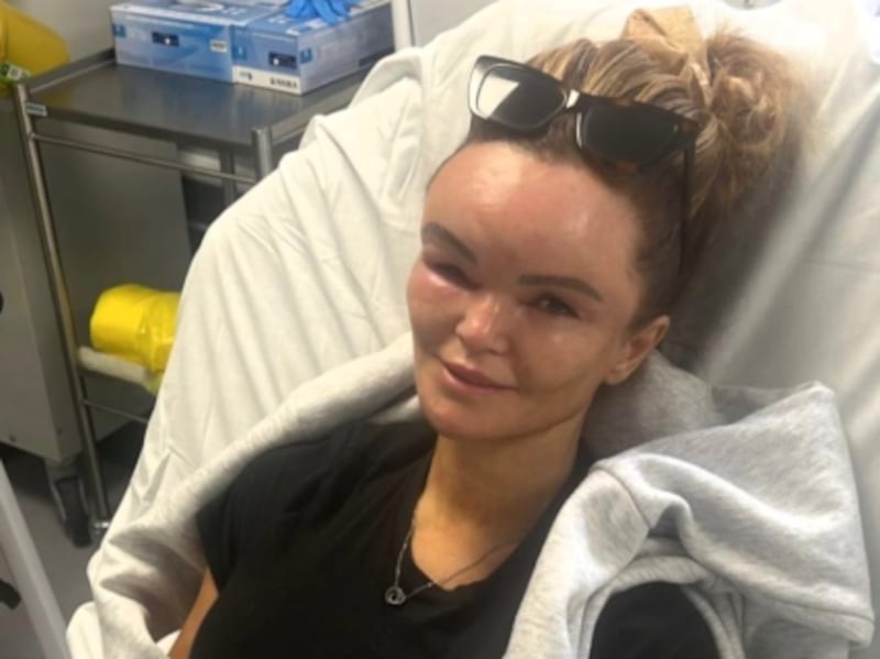 El drástico cambio que sufrió una mujer tras un accidente de tránsito - Fuente: Foto de la web