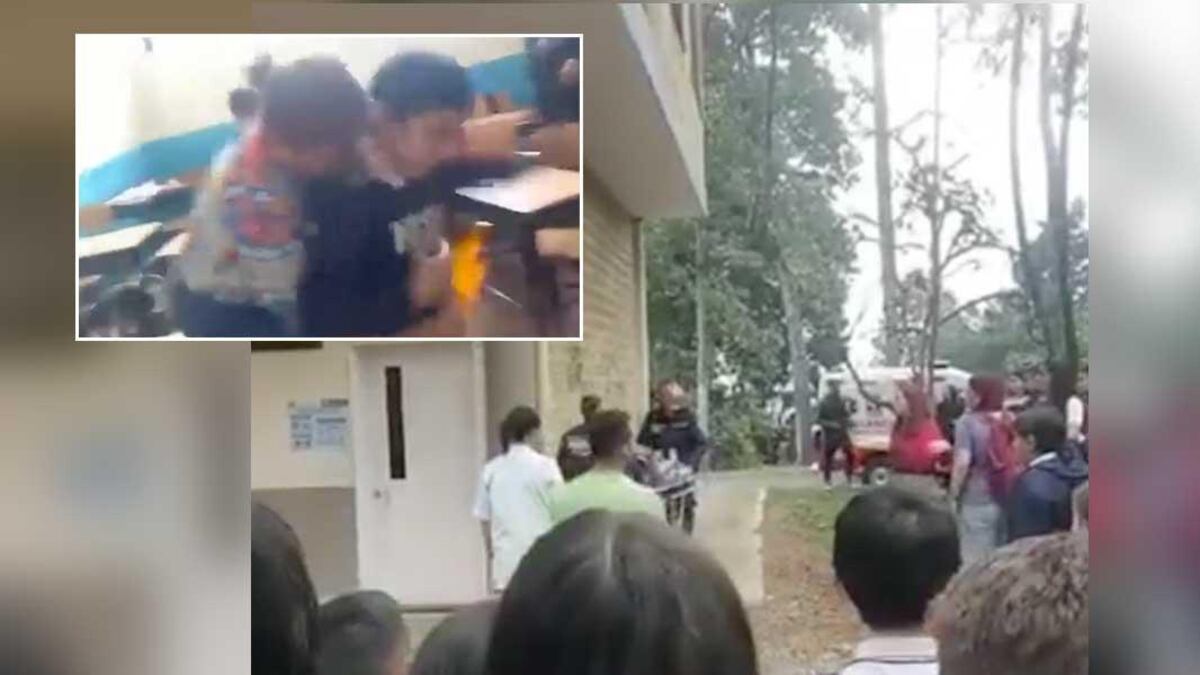 El fuego provocó quemaduras de segundo grado en los afectados