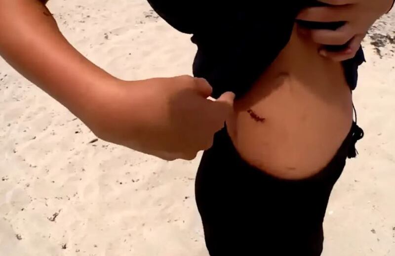 Heridas de Ella Reed