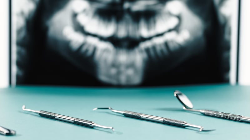 Anestesia general en odontología: cuándo se debe usar y qué riesgos existen