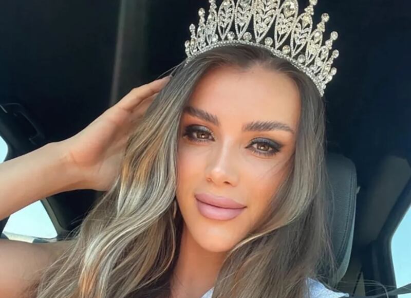 Güler Erdogan, una modelo y exreina de belleza de Kosovo