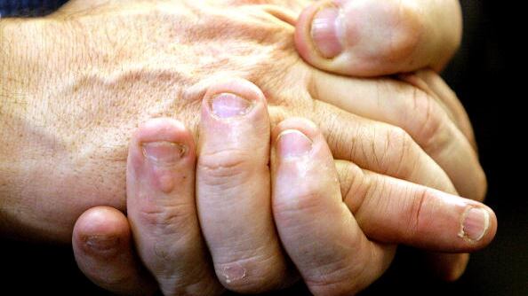 El hombre estuvo al borde de la muerte