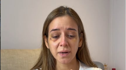 Scarlett Córdova rompe el silencio y cuenta cómo fue golpeada brutalmente por su expareja en el feriado