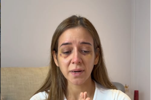 Scarlett Córdova rompe el silencio y cuenta cómo fue golpeada brutalmente por su expareja en el feriado