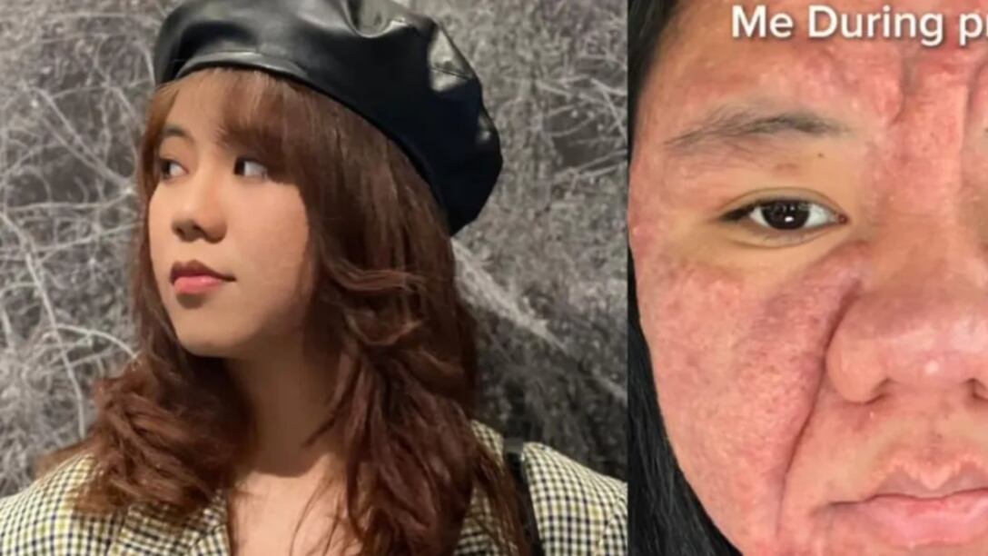 El impactante cambio físico en su rostro que tuvo una mujer durante y después de su embarazo