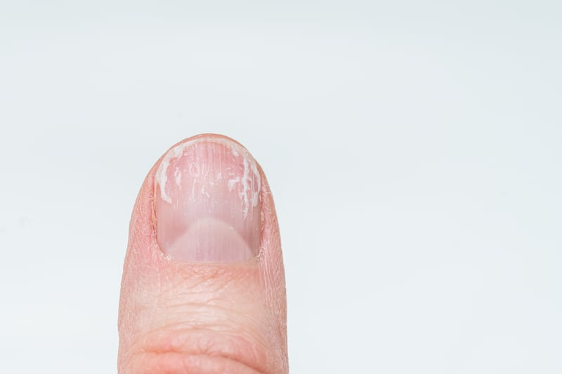 uñas y salud