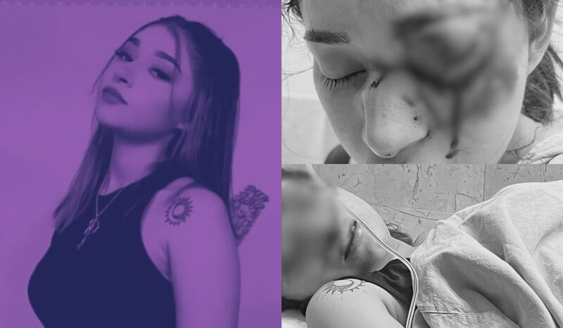 Caso Melanie Tamaulipas: Estado de salud actual de la estudiante golpeada por su novio Cristian