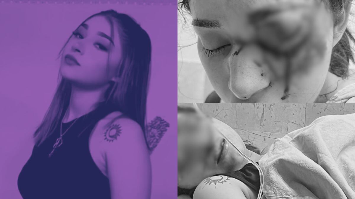 Caso Melanie Tamaulipas: Estado de salud actual de la estudiante golpeada por su novio Cristian