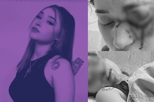 Conoce el estado de salud actual de Melanie, estudiante golpeada por su novio en Tamaulipas