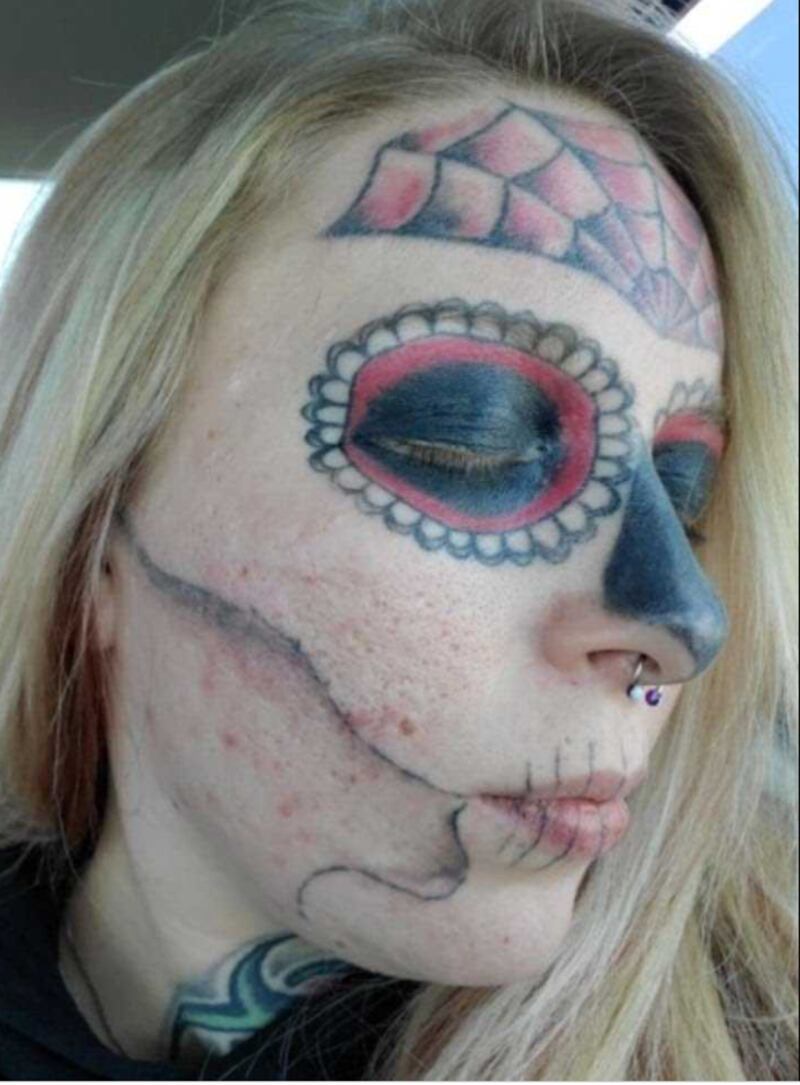 Alyssa Zebrasky elimina los tatuajes de su rostro