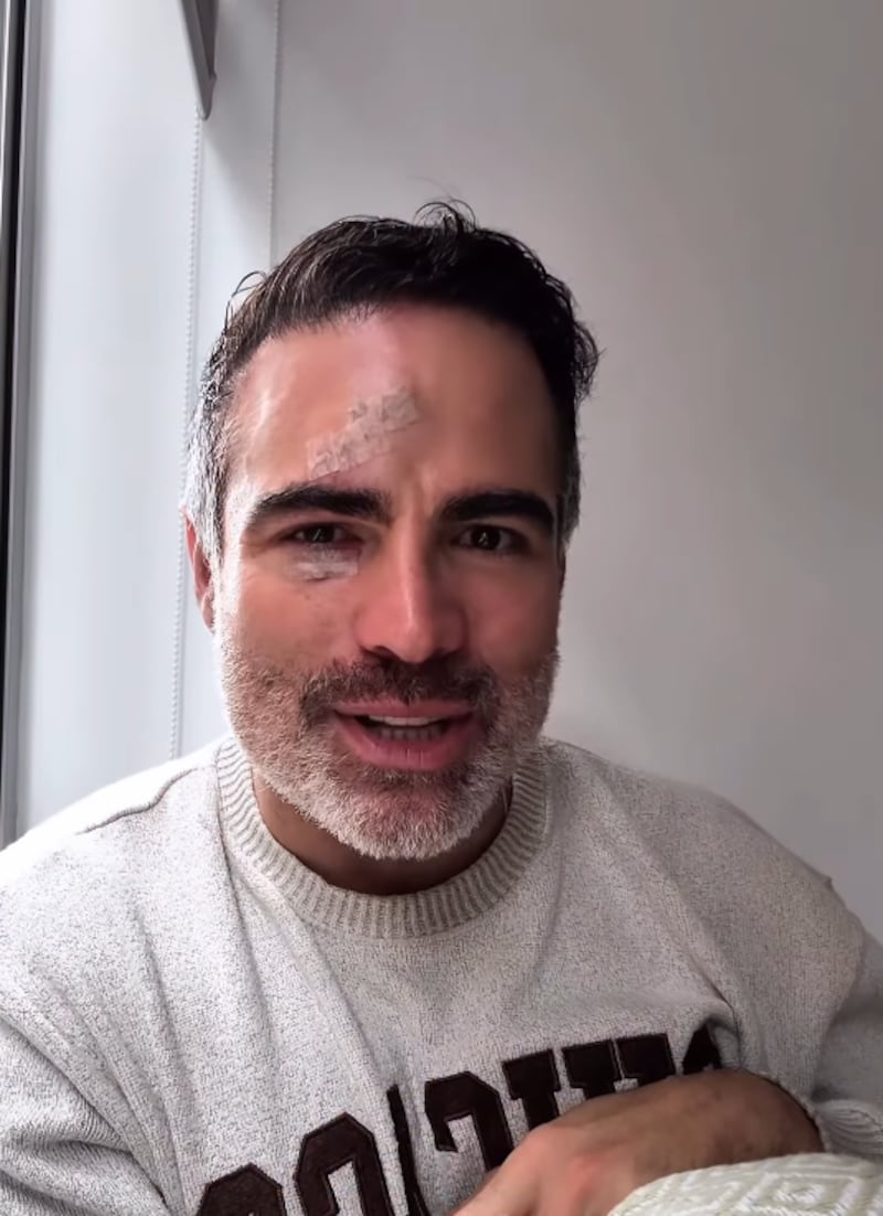 El actor ecuatoriano Roberto Manrique sufrió un accidente en su preestreno Tantas Flores.