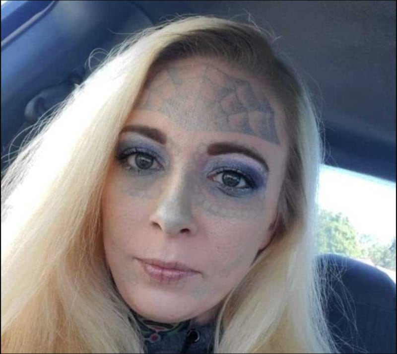 Alyssa Zebrasky elimina los tatuajes de su rostro