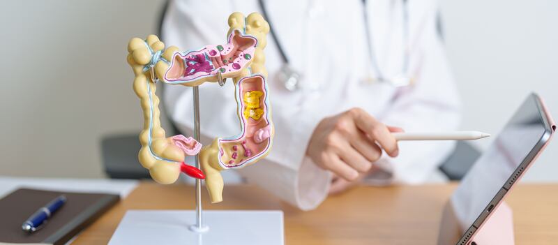 Diferencias entre cáncer de colon y cáncer de recto
