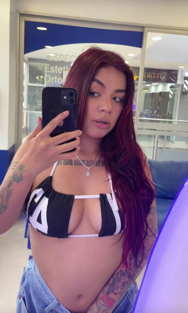 Samanthrux antes de la cirugía