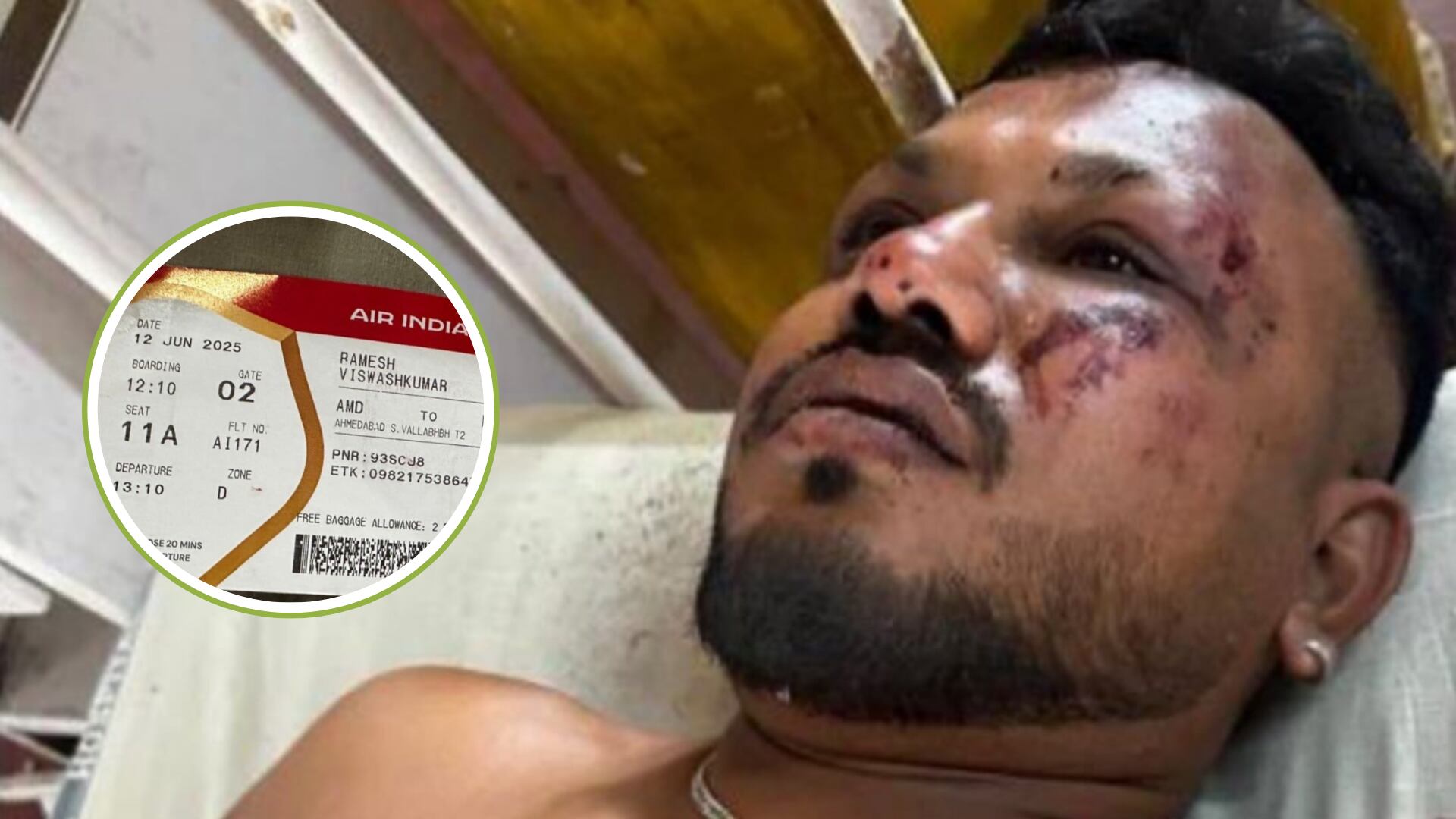 Encontraron un sobreviviente del accidente aéreo en India: contra todo pronóstico salió caminando del lugar