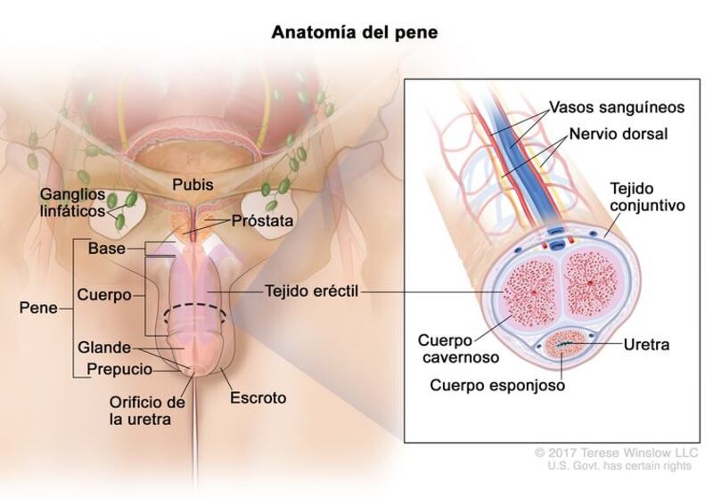 Cáncer de pene