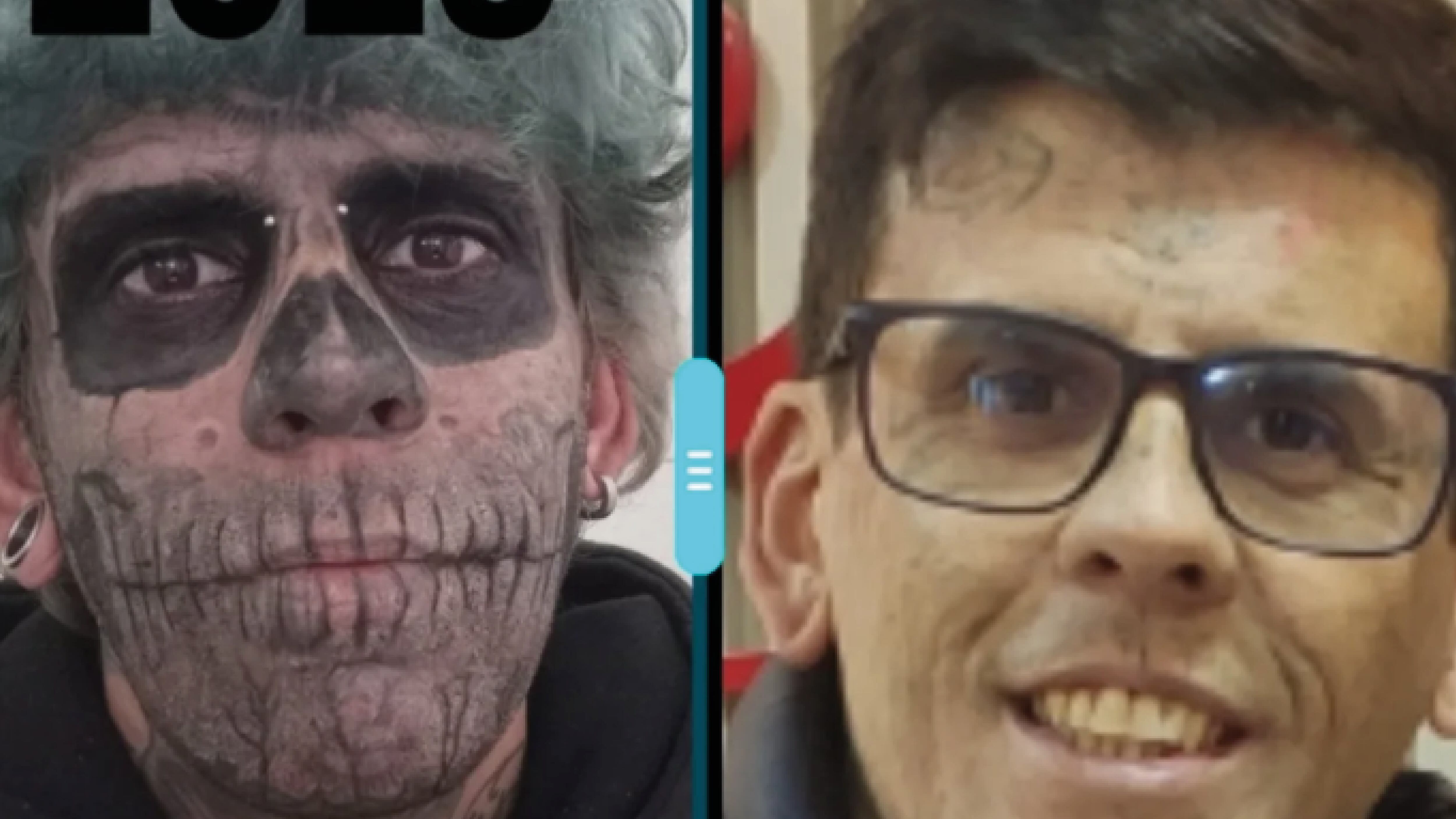 Leandro Souza, el hombre más tatuado de Brasil se borra más de 170 tatuajes y así luce