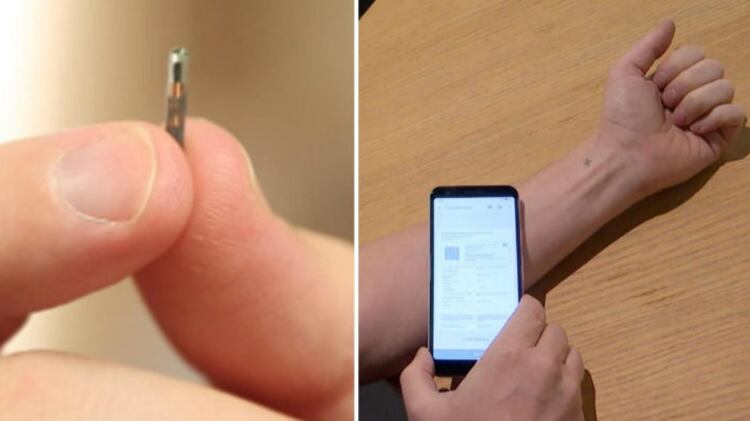 La tecnología avanza y este microchip implantado en la piel, lo confirma.
