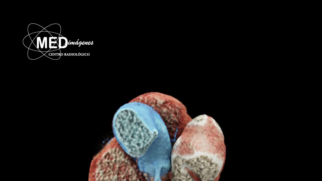 MEDimágenes: Nuevos estudios que observan a tu corazón con mayor detalle