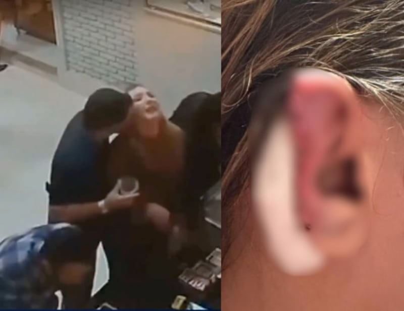 hombre arranca oreja a su pareja