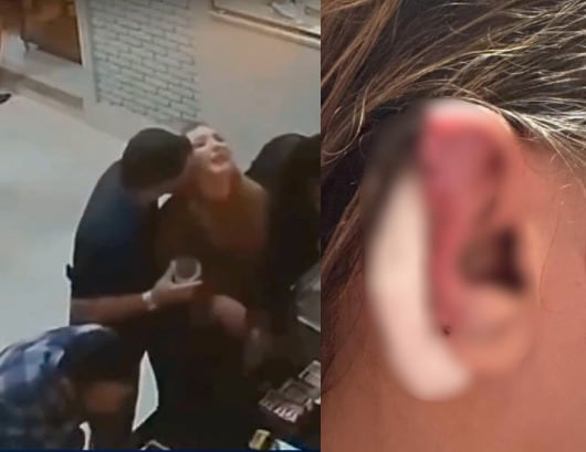 hombre arranca oreja a su pareja