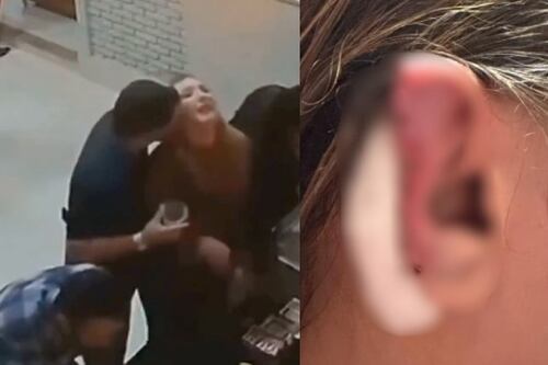 Video: Hombre muerde y arranca parte de la oreja a su pareja en Brasil
