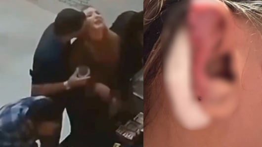 hombre arranca oreja a su pareja