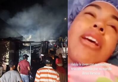 Roxana Parra sobrevivió a un ataque con gasolina de su expareja en El Tamarindo, Yaracuy.
