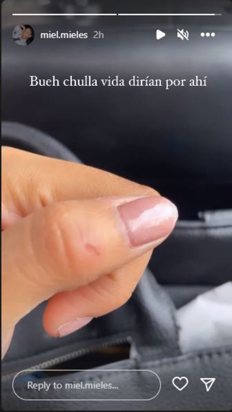Gilliam Mieles publicó historia de un corte que se hizo en las manos