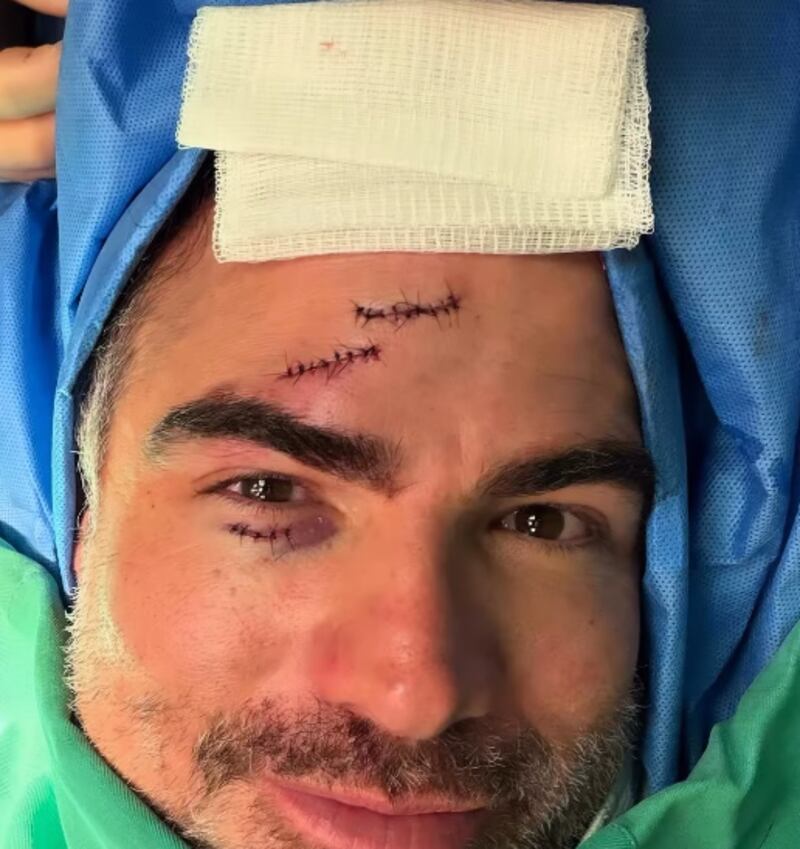 El actor ecuatoriano Roberto Manrique sufrió un accidente en su preestreno Tantas Flores.