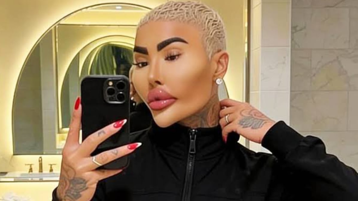 Muere reconocido influencer tras presunta cirugía: el hombre quería verse como Kim Kardashian