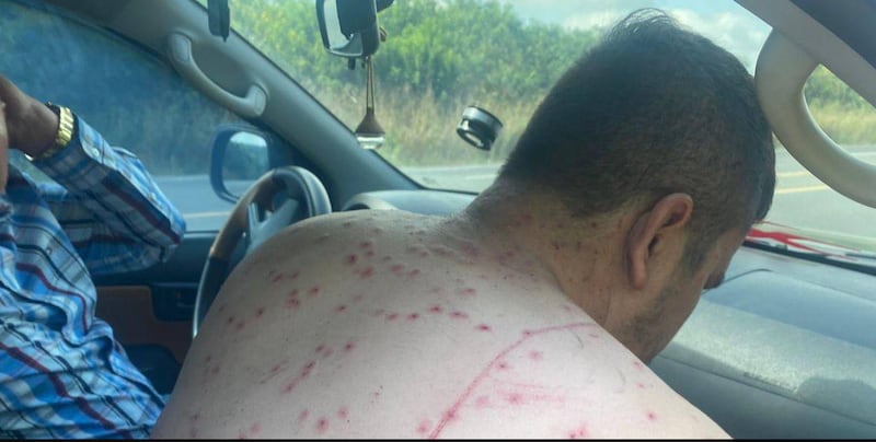 Así quedó el ocupante de un vehículo tras un ataque de abejas luego de chocar contra un panal