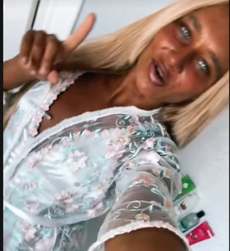 Megan Blain muestra su piel manchada por bronceado extremo