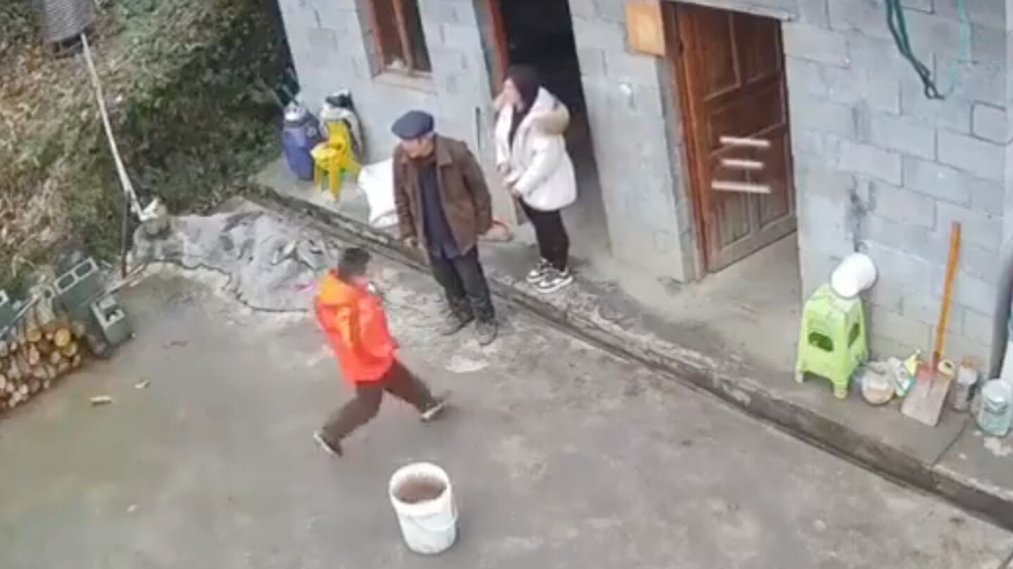 Niño desfigura el rostro de su madre con un petardo durante juego familiar