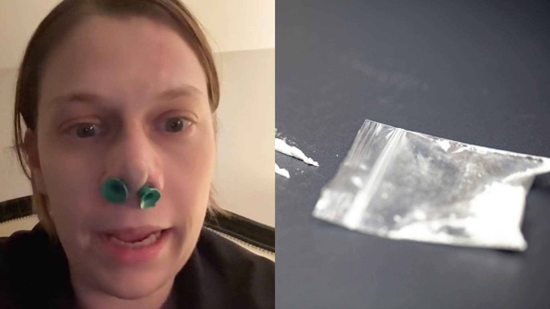 A una mujer le colocaron un pedazo de su cabeza en el rostro debido a su adicción