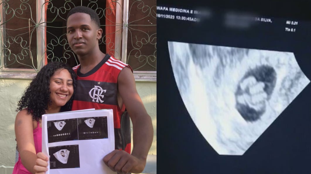 La conmovedora historia de joven de 18 años dará a luz a quintillizos.