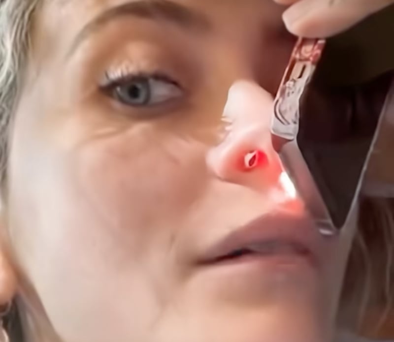 Paris Jackson muestra la secuela nasal que le dejó su adicción a las drogas.