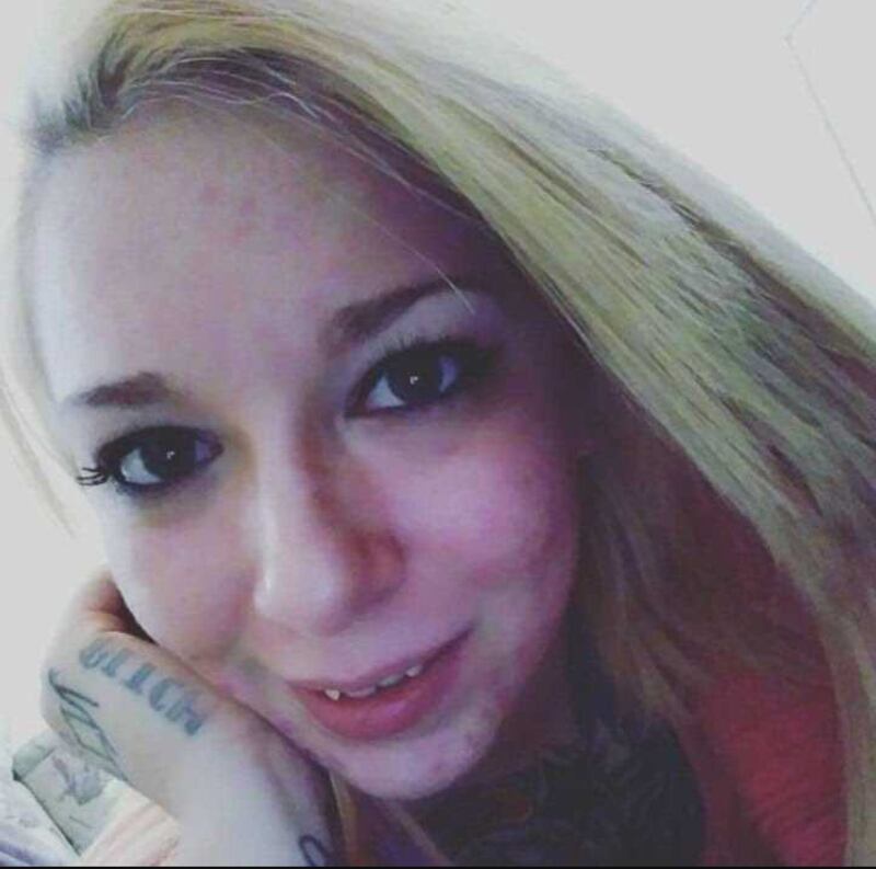 Alyssa Zebrasky elimina los tatuajes de su rostro