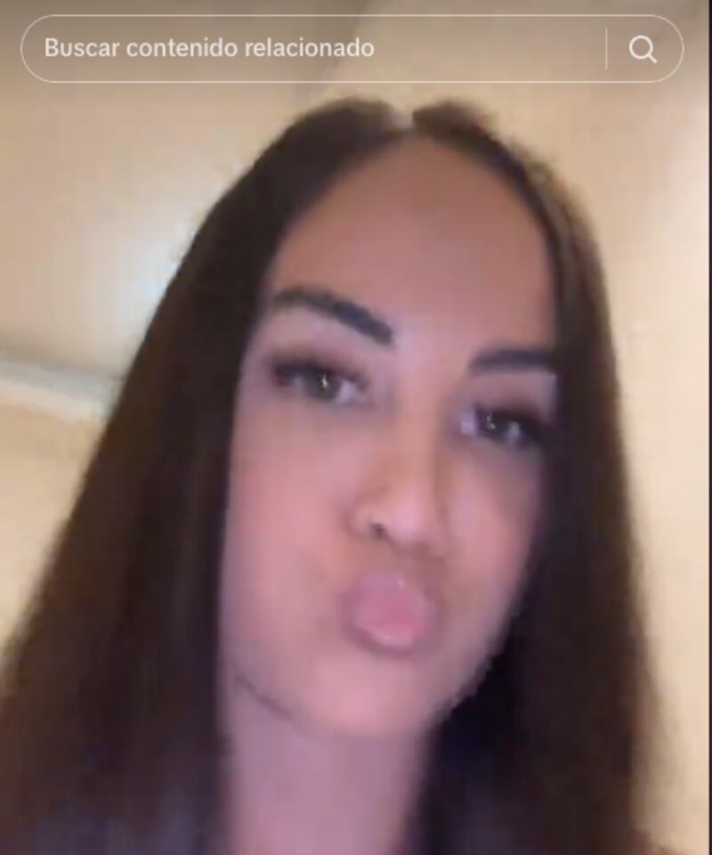 Así lucía modelo antes de operarse su rostro, a reducción de frente y fox eyes