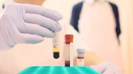 Descubren dos mujeres que tienen la 'sangre dorada' en China