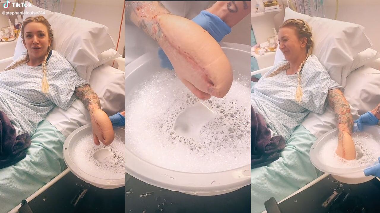 Mujer se hace viral por tener mano de tiburón