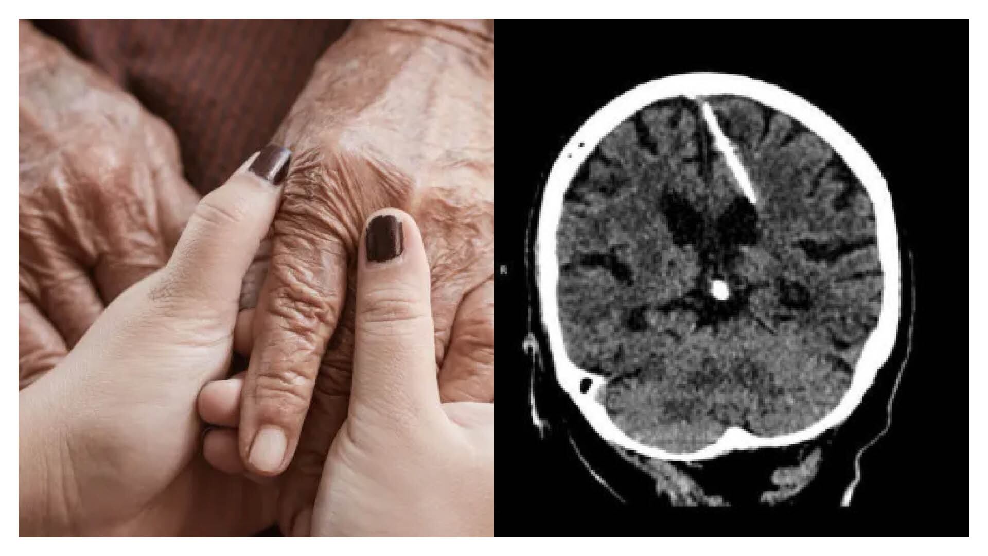 Después de décadas encontraron el “extraño cuerpo” por accidente.